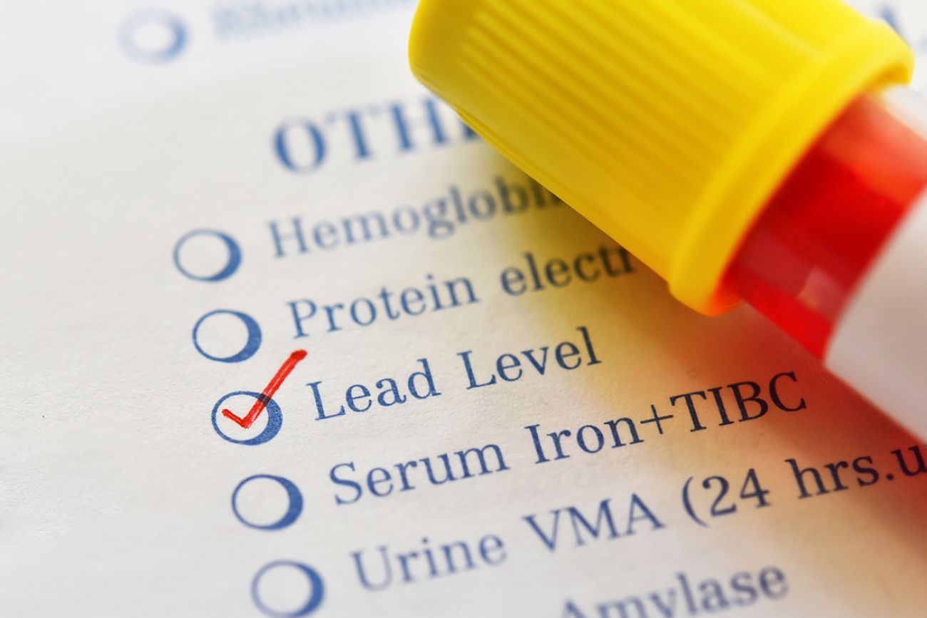 Test tube with blood sample for lead level test